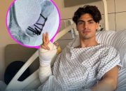 Fermín Aldeguer Absen di MotoGP Australia Usai Cedera di Mandalika, Iker Lecuona Jadi Pengganti
